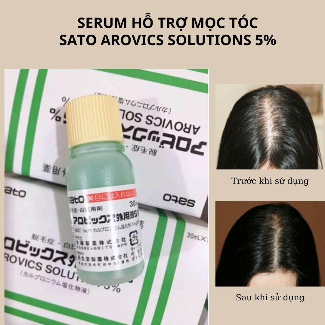 Serum hỗ trợ mọc tóc Sato Arovics Solutions 5% 30ml