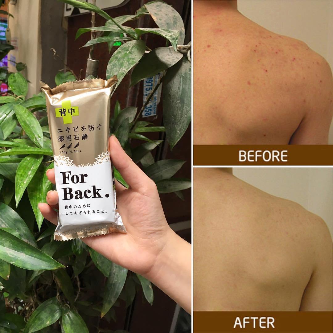 alt-tag xà phòng trị mụn lưng For Back