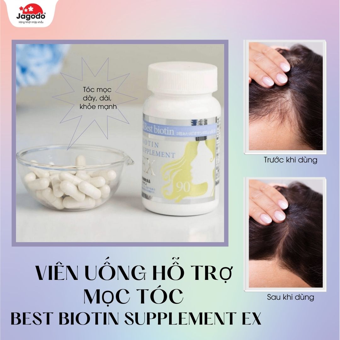 Viên uống hỗ trợ mọc tóc Best Biotin Supplement EX 