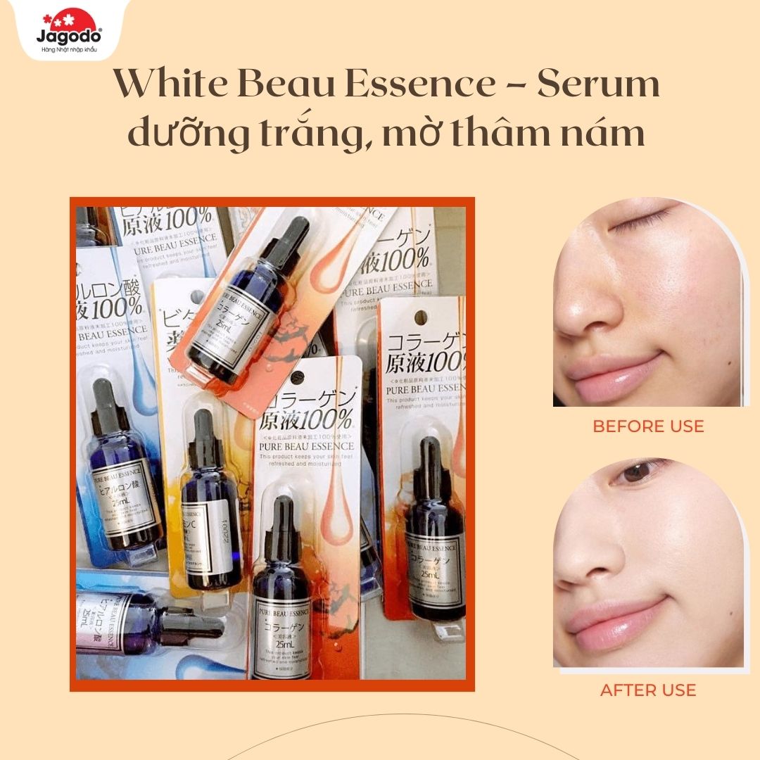 Serum dưỡng trắng, mờ thâm nám White Beau Essence 25ml