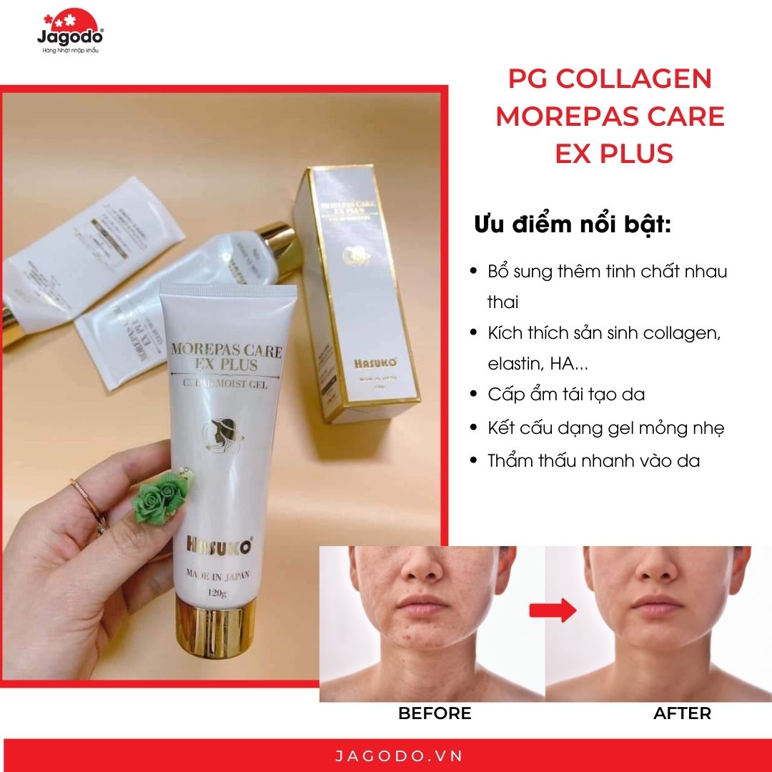 Gel dưỡng da chiết xuất sụn vi cá hồi PG Collagen Morepas Care EX Plus 120g