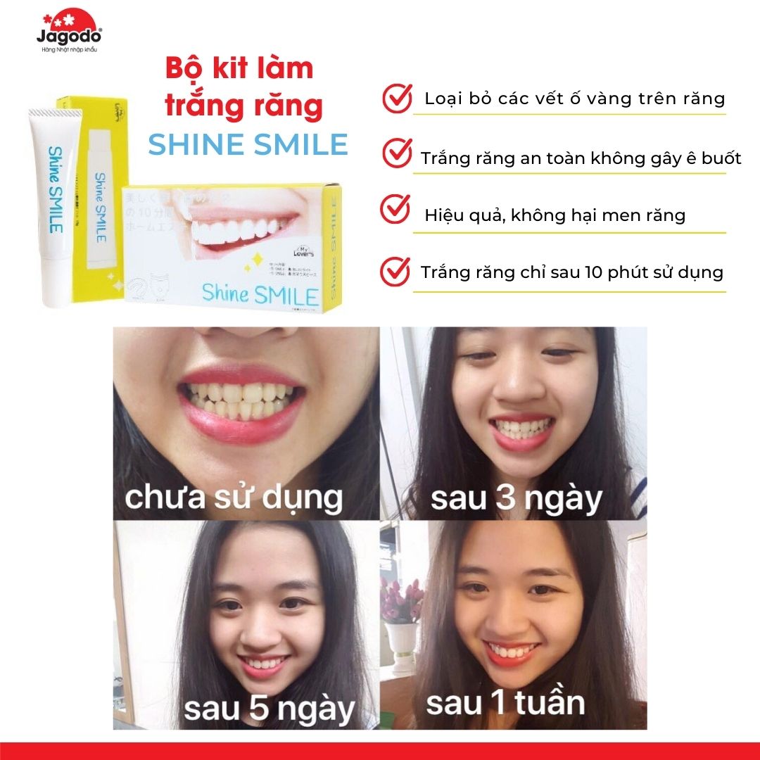 Bộ kit làm trắng răng Shine Smile Nhật Bản