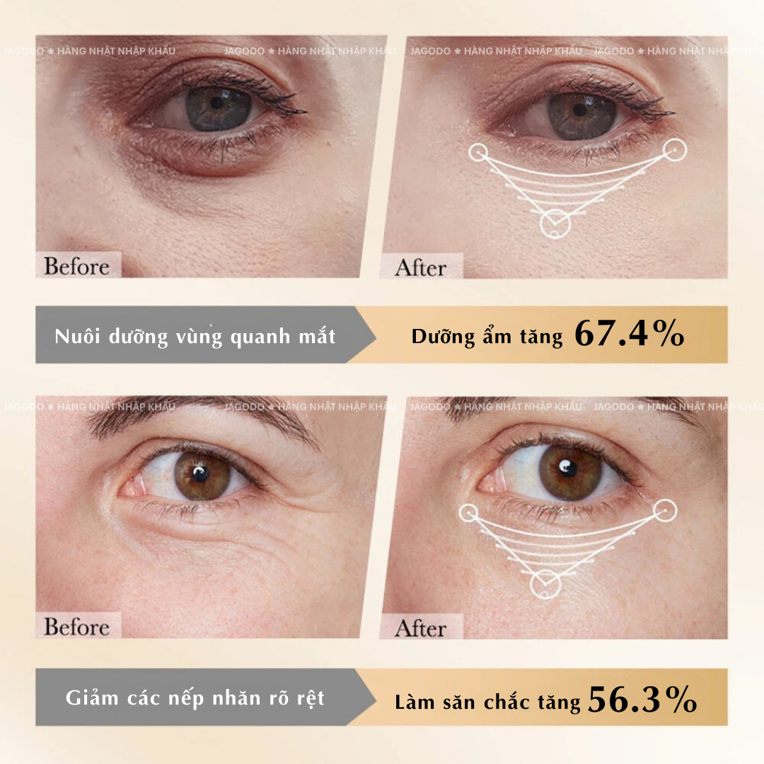 581c201b 7 - Mặt nạ mắt Hydrogel Eye Mask Nhật Bản