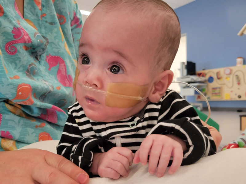 A closeup of a baby on his tummy, he is looking to his right, he has a tube coming out of his nose