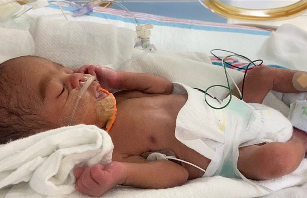 A closeup of a sleeping baby in a hospital