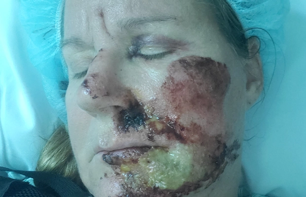 woman with injured face