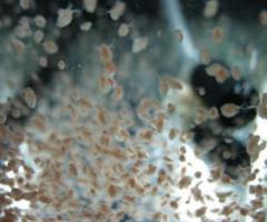 Daphnia, free live food for ornamental fishes