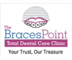 The Braces Point