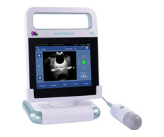 Bladder Scanner Explained: A Non-Invasive Tool for Accurate Urinary Diagnosis
