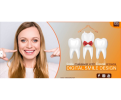 Best Dental Implant Clinic in Panjagutta | 32+ Years of Trusted Care - Image 3