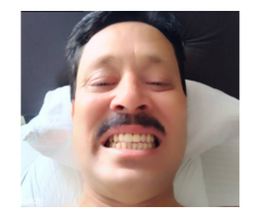 Best Dental Implant Clinic in Panjagutta | 32+ Years of Trusted Care - Image 4