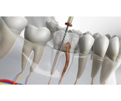 Dental Clinic | Bangalore | Best Dental Care | Discover Your Smile - Image 2