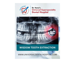 Wisdom Tooth Extraction – A Complete Guide for Pain-Free Recovery