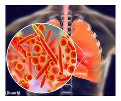 Advanced Lung Cancer Care Doctor in Ajmer, Rajasthan – Dr. Sheetu Singh
