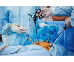 Laparoscopic Surgeon in Delhi