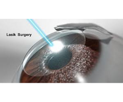 Best LASIK Surgeon in Noida | LASIK Eye Surgery