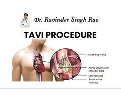 Trusted Heart Doctor for Angioplasty & Cardiac Treatment in Jaipur, Rajasthan | Dr. Ravinder Sin