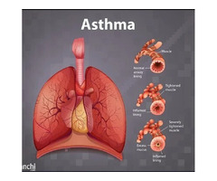 Expert Doctor for Allergic & Chronic Asthma in Jaipur | Dr. Virendra Singh