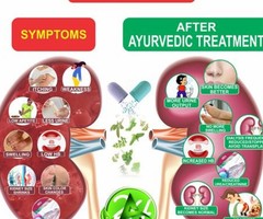 Ayurvedic Medicine for Kidney Failure