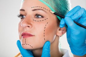 Close-up Of A Surgeon Drawing Perforation Lines On Young Woman's Face