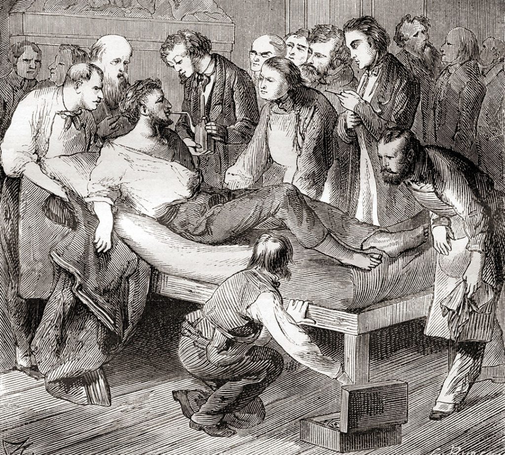 The first public demonstration of the use of inhaled ether as a surgical anaesthetic in 1846 by an American dentist, William Thomas Green Morton (1819 – 1868)