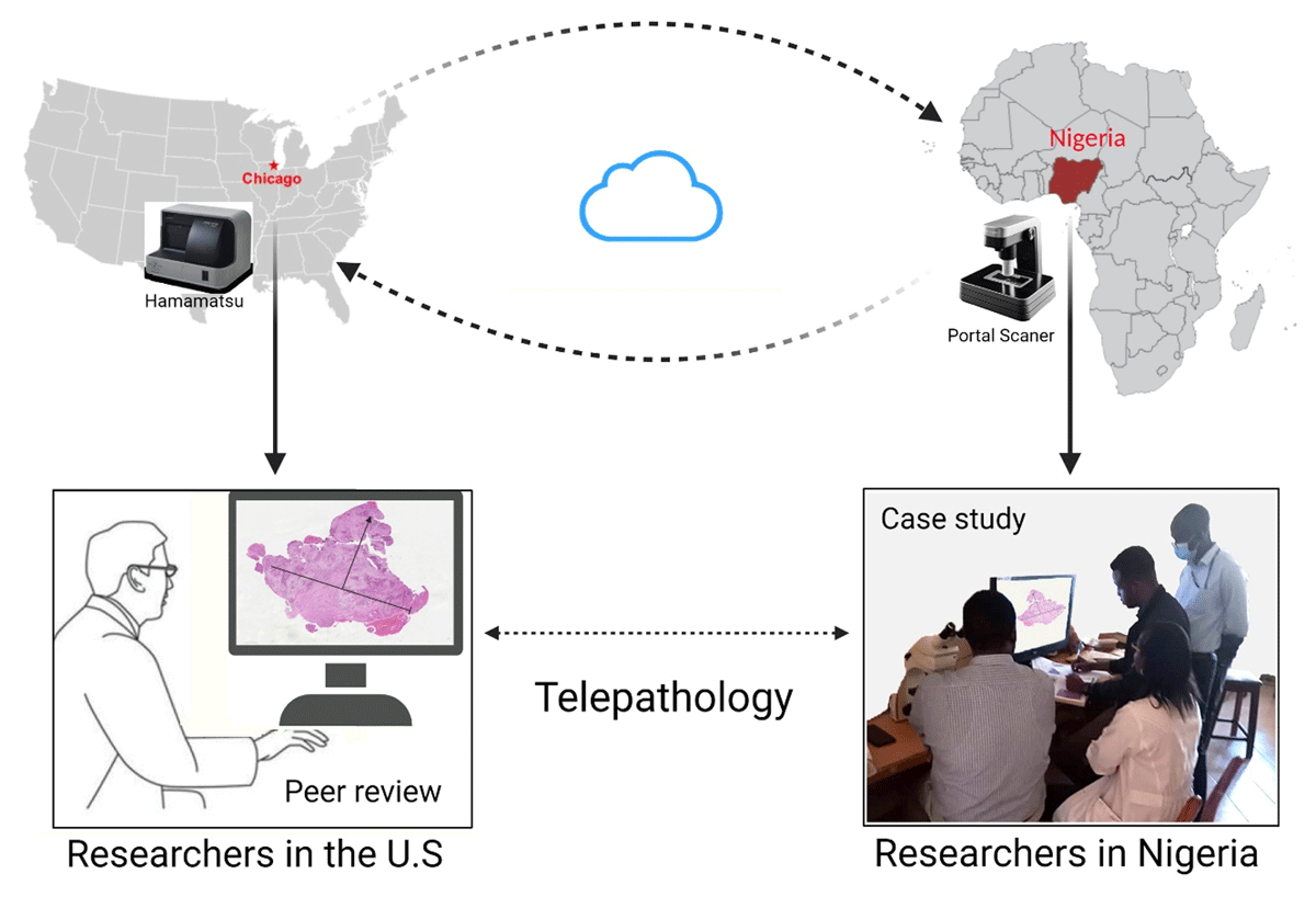 Telepathology synergy between Nigerian and American institution