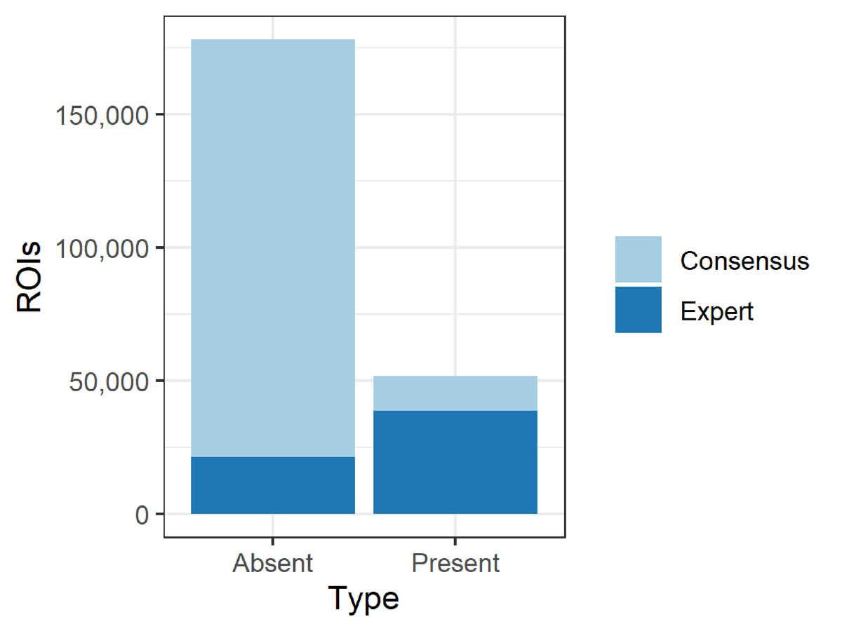 Stacked bar graph divided by consensus and expert with two categories (absent and present) on x-axis, and number of ROIs from 0-200,000 on y-axis. ~25,000 expert-validated absent ROIs and ~37,000 present ROIs. ~150,000 consensus-validated absent ROIs and ~13,000 present ROIs
