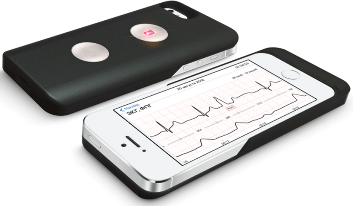 Smartphone-case based ECG device (CardioQVARK®) including also pulse-wave analysis by photopletysmography (not included in this study).