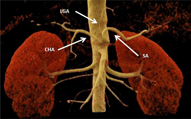 abdominal aorta celiac trunk