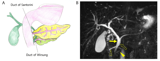 pancreatic duct anatomy