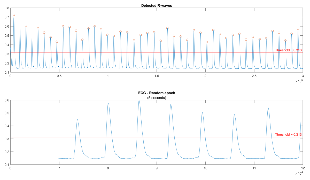 Threshold estimation. The function getEcgThresh detects the R-waves and estimates a threshold as a percentage of the average R-wave amplitude. The detected R-waves are marked with a circle, while the threshold is displayed as a red horizontal line.