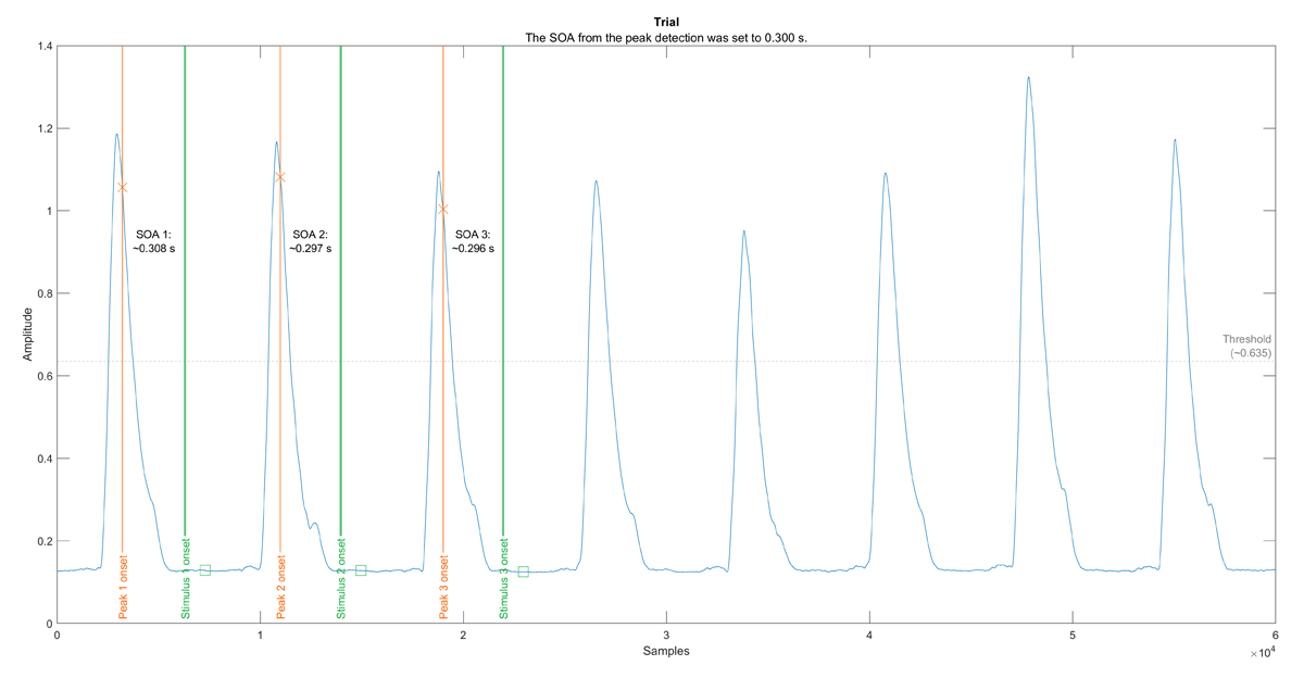 Trial’s plot. The function plotTrial shows the ECG used in a specific trial, as well as the events of interest. The onsets of detected R-waves and presented stimuli are marked by orange and green vertical lines, respectively. The offset of the stimulus is marked by a green square. The threshold used for the cardiac-contingent presentation of the stimuli is also shown as a dashed, horizontal line.