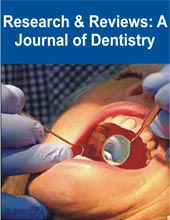 Research & Reviews: A Journal of Dentistry Cover