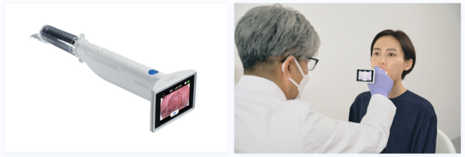 アイリスが開発したnodoca（左）を使った検査写真（右）。咽頭画像と体温や自覚症状等をAIが解析することで、インフルエンザに特徴的な所見や症状等を検出する。&nbsp; &nbsp; &nbsp;アイリスHPより<br>