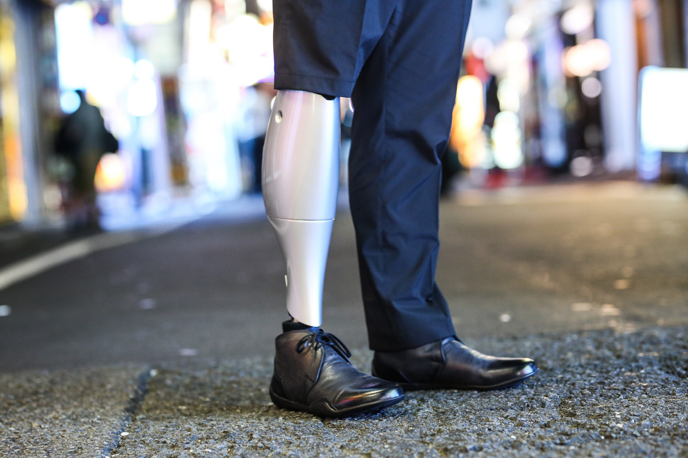 [Podcast] How one innovative startup is selling true bionic legs