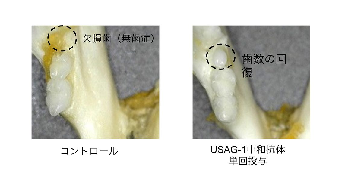 先天性無菌症モデルマウスのの先的欠如歯の回復&nbsp; &nbsp; &nbsp;トレジェムバイオファーマー提供