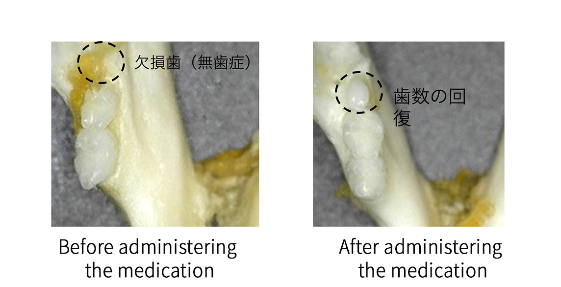 Recovery of congenital missing teeth in a mouse model of edentulism (EDA KO). The right image shows the regenerative effects of a single dose of the USAG-1 neutralizing antibody compared to the control group (left).&nbsp; &nbsp; &nbsp;Source: Toregem Bio Pharma Co.