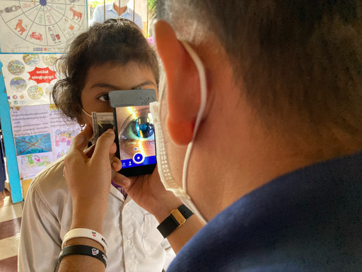 カンボジアで子供の診療で使用されるSmart Eye Camera（SEC)&nbsp; &nbsp; &nbsp;OUI Inc. 提供