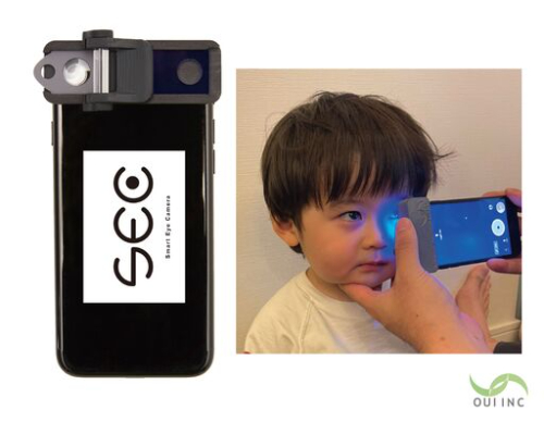 Smartphone device enables detection of eye disease