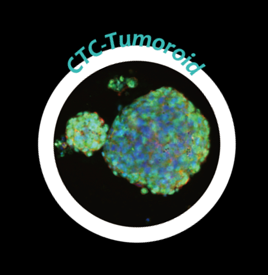 CTC（Circulating Tumor Cells）から形成されたオルガノイドの顕微鏡画像。&nbsp; &nbsp; &nbsp;