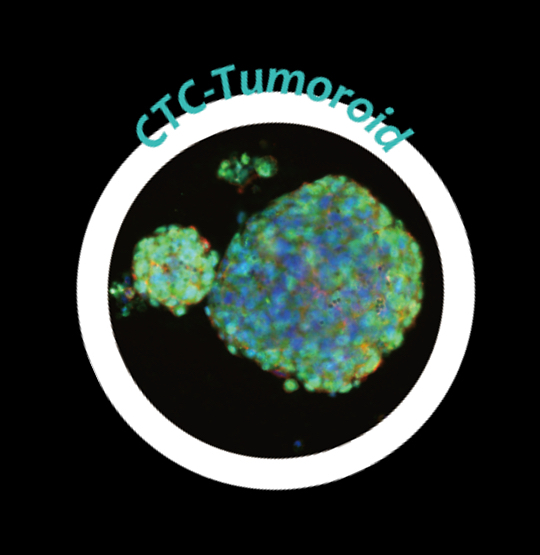 An organoid made of CTC (Circulating Tumor Cells) seen through a microscope.&nbsp; &nbsp; &nbsp;&nbsp;