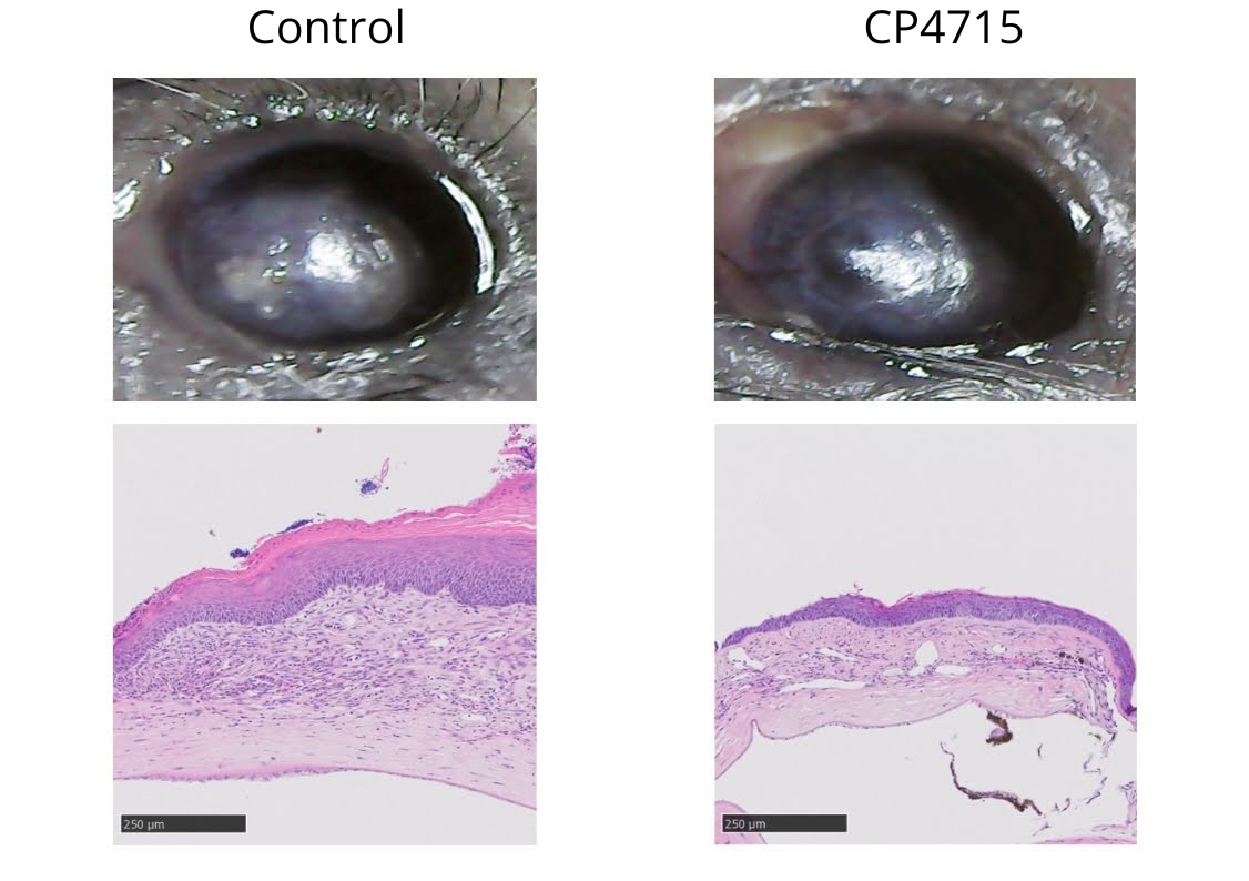 In the eye of a mouse treated with the periostin inhibitor (CP4715) (right), inflammation has improved