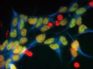 ネスチン（青）、クロマチンタンパク質（緑）、DNA（赤）の免疫染色像（培養マウス神経前駆細胞）