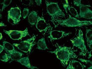 抗ミトコンドリアタンパク質抗体を用いた免疫染色像（HeLa 細胞）
