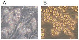 脂肪成分の添加により脂肪滴が肥大化する
A：コントロール
B：培養5日目から2日間、1％のIntrafat (脂肪成分) を添加した。(Intrafat Injection 20%, Nippon Pharmaceutical Co., Ltd., Tokyo, Japan)