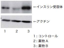 ウェスタンブロッティングによるインスリン受容体の発現確認(オプション)