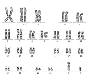 G-bandによるカリオタイピング　ヒトiPS細胞(46,XY)
G-band, human iPS cells