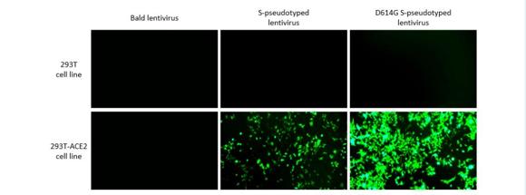 SARS-CoV-2 Sタンパク質シュードタイプレンチウイルスをヒトACE2受容体を過剰発現した293T細胞に感染させた。形質導入後72時間の細胞を撮影