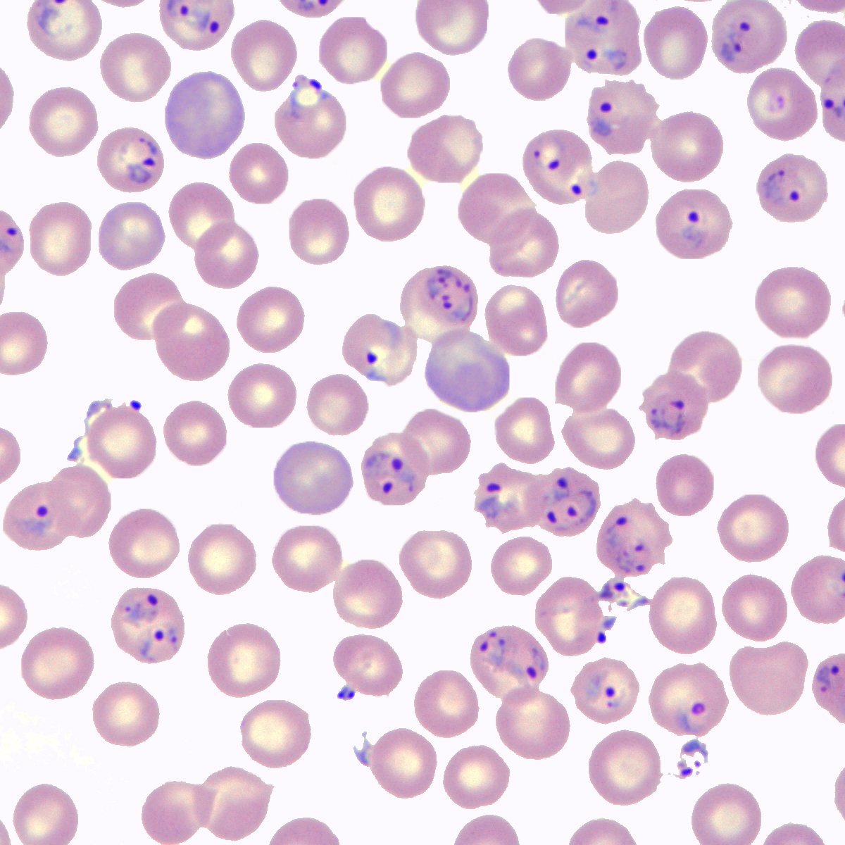 BioImage Informatics II Malaria Dataset | Kaggle