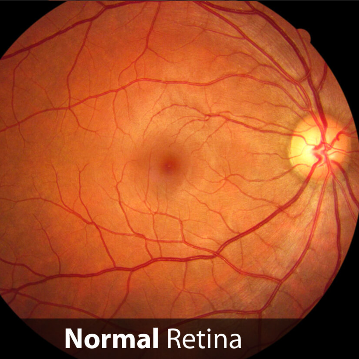 drive-digital-retinal-images-for-vessel-extraction-kaggle